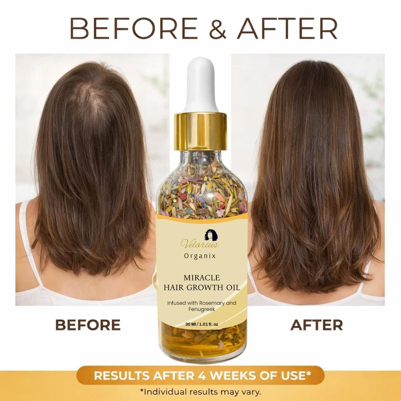 Miracle Hair Growth Oil 30 ml (Pack of 1)